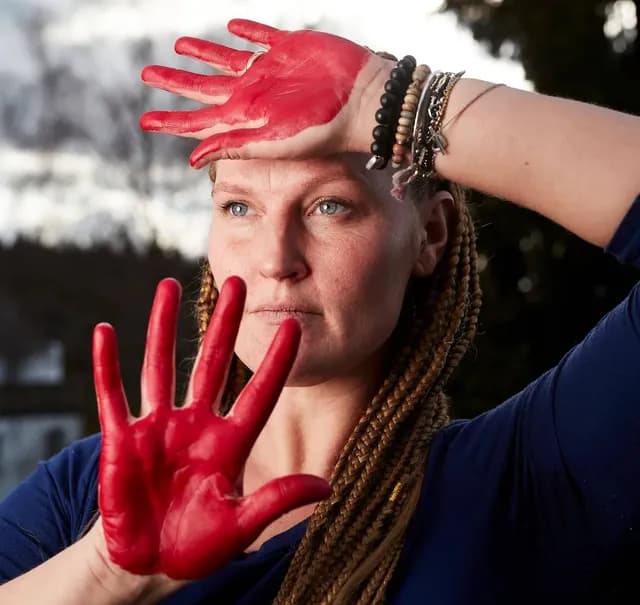 «Mein Körper ist auch mit nur einem Bein ein Kunstwerk»